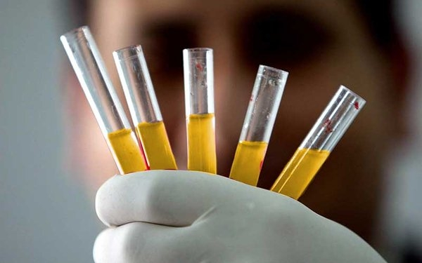 SOME THINK THIS BLOOD TYPE HAS AN ALIEN ORIGIN… – PARADIGM SHYFT
